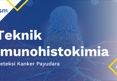 Deteksi Kanker Payudara Dengan Teknik Imunohistokimia